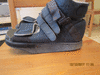 Специальная обувь после операции на вальгус