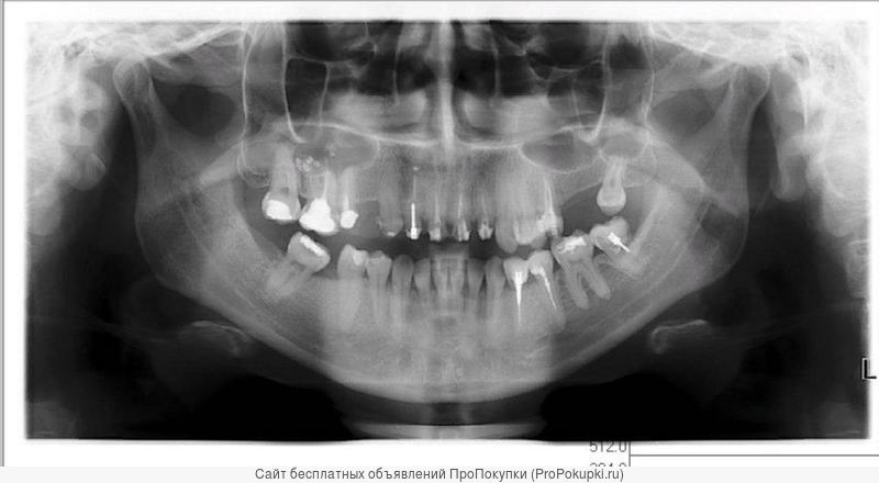 зубной снимок сканировать в иркутске срочно